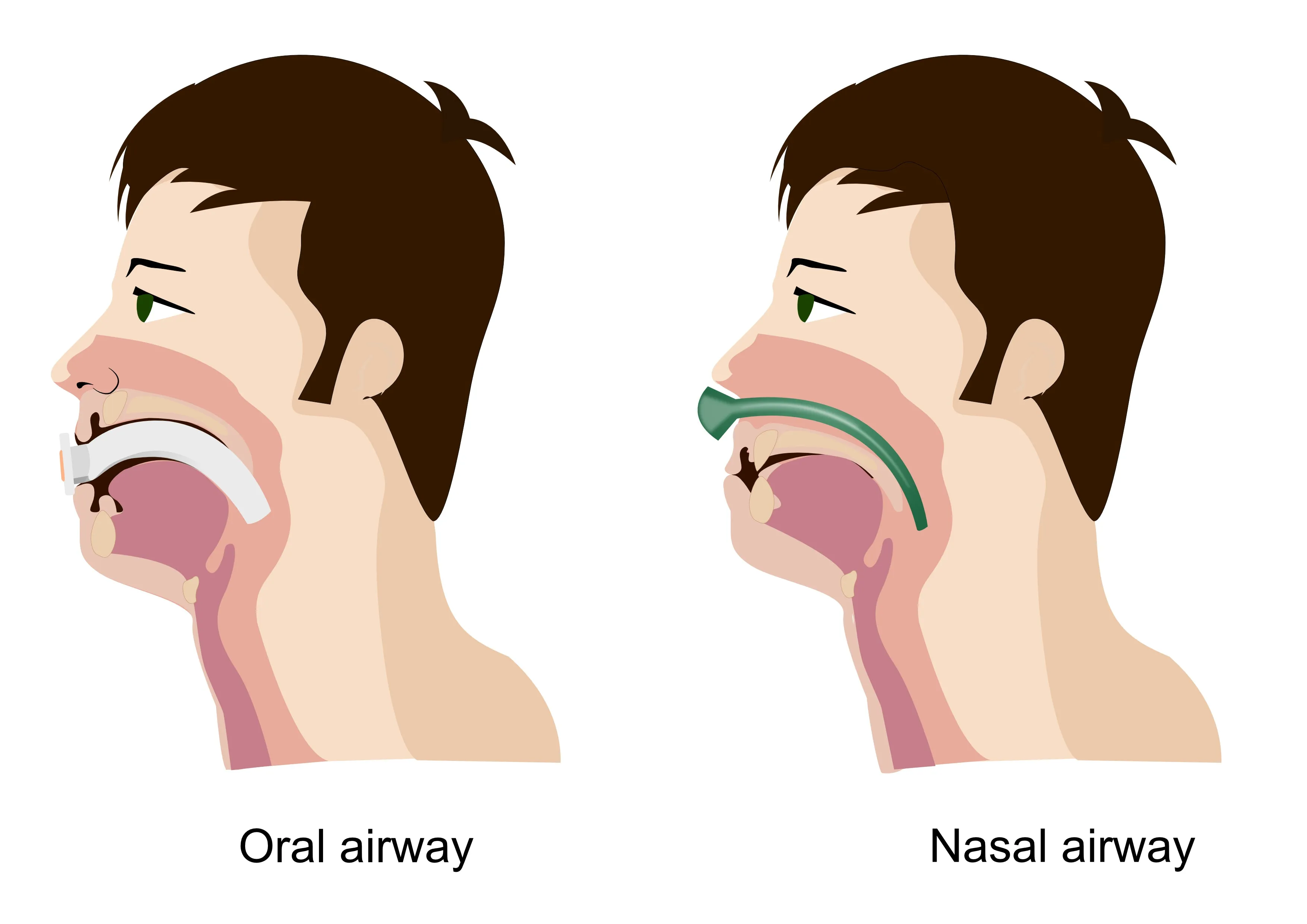 Complete Airway Emergency KIT 5